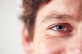 Anti-Wrinkle Injections for Man
